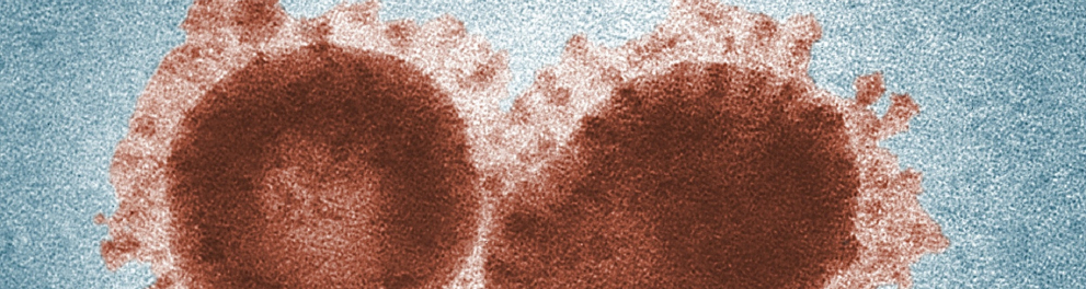Imagem microscópica de algum vírus marrom