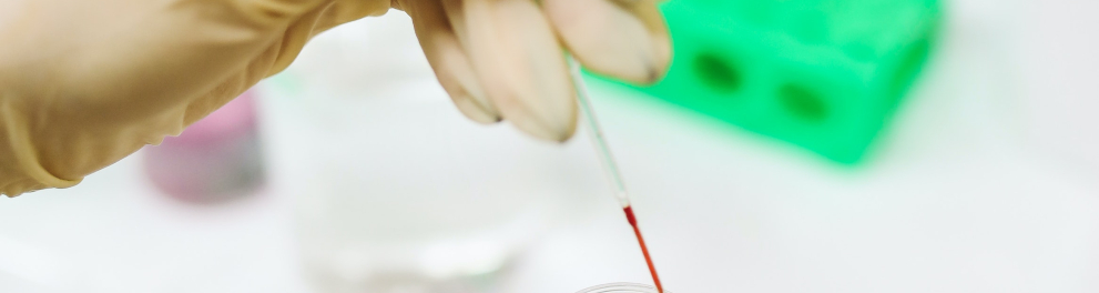 Gostas de sangue estão sendo despejadas em um pequeno recipiente. Podemos ver duas mãos usando luvas medicinais coletando manuseando o sangue 