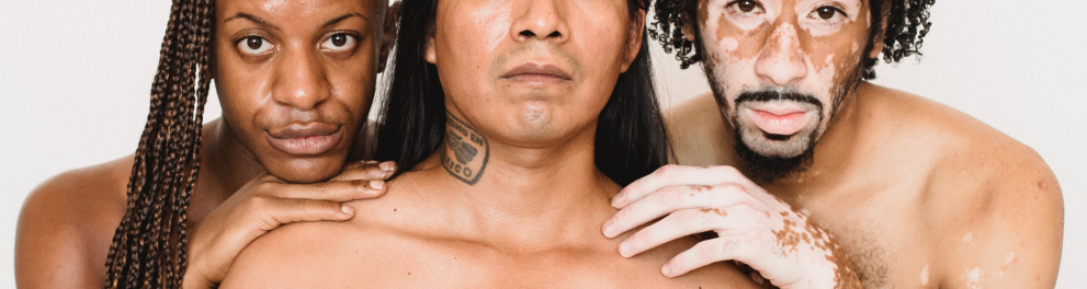 Um homem negro de cabelo com tranças longas, um homem com traços mexicanos e um homem com vitiligo pelo rosto e mão estão sem camisas e lado a lado olhando com seriedade para quem bateu a foto