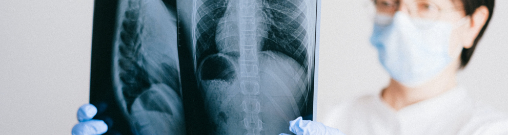 Uma mulher com luvas descartáveis e máscara de prevenção à Covid está segurando chapas dos pulmões de alguém e observando atentamente