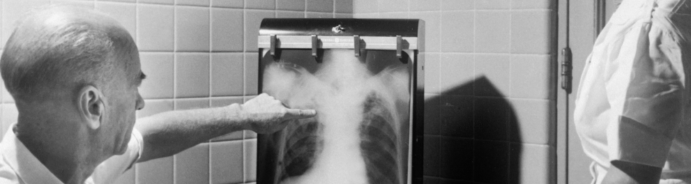 Foto em preto e branco de um médico apontando para uma radiografia pulmonar enquanto a enfermeira observa