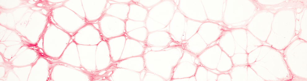 Imagem microscópica do que parecem ser células avermelhadas ou algum tipo de tecido humano