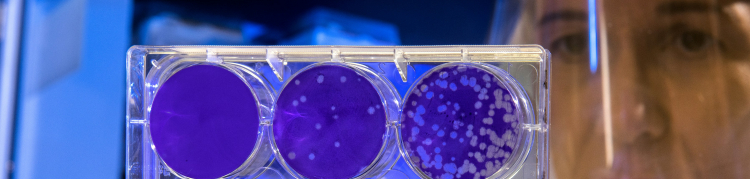 Uma cientista está segurando uma pequena estrutura de vidro contendo seis circunferências compostos por um líquido azul