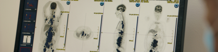 A imagem mostra o exame de um paciente em tratamento oncológico